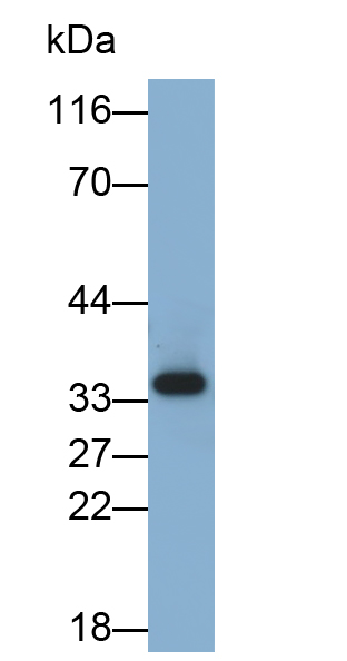 腫瘤壞死因子受體超家族成員1A(TNFR1)多克隆抗體