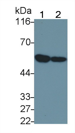 腫瘤壞死因子受體超家族成員1A(TNFR1)多克隆抗體
