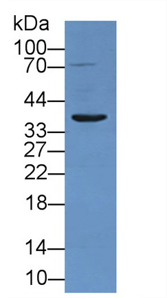 肿瘤坏死因子受体超家族成员1A(TNFR1)多克隆抗体