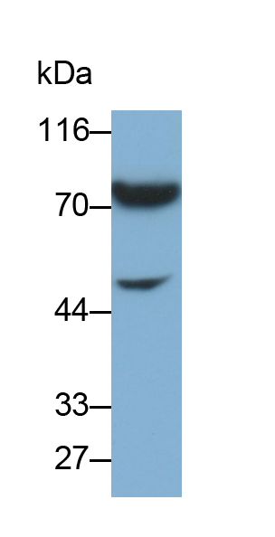 肿瘤坏死因子受体超家族成员1A(TNFR1)多克隆抗体