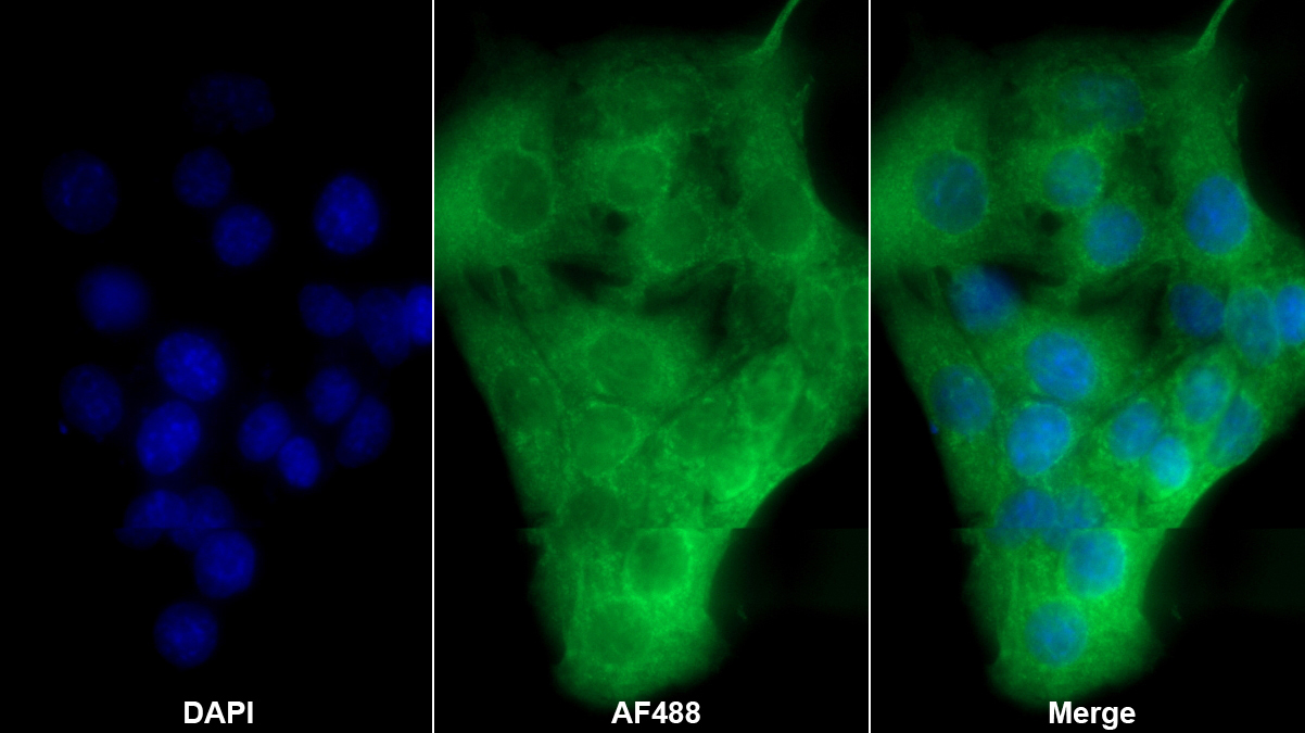 腫瘤壞死因子受體超家族成員1A(TNFR1)多克隆抗體