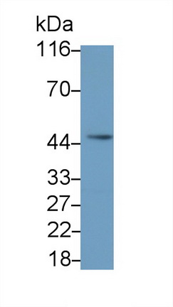 白介素5受體α(IL5Ra)多克隆抗體