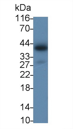 白介素2受体γ(IL2Rg)多克隆抗体