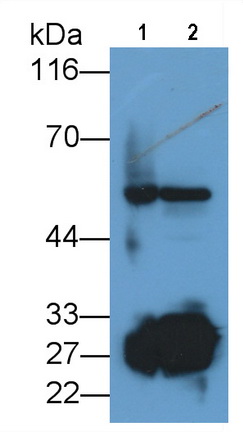 絲氨酸蛋白酶2(PRSS2)多克隆抗體