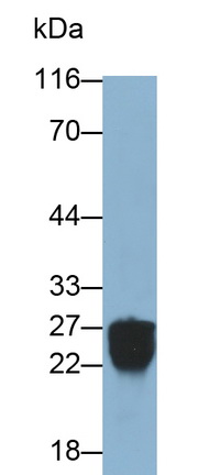 絲氨酸蛋白酶2(PRSS2)多克隆抗體