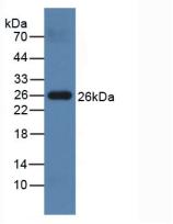 絲氨酸蛋白酶2(PRSS2)多克隆抗體