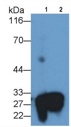 絲氨酸蛋白酶2(PRSS2)多克隆抗體