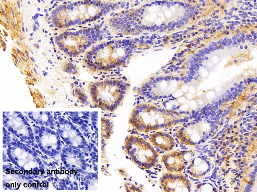 細(xì)胞外基質(zhì)金屬蛋白酶誘導(dǎo)因子(CD147)多克隆抗體