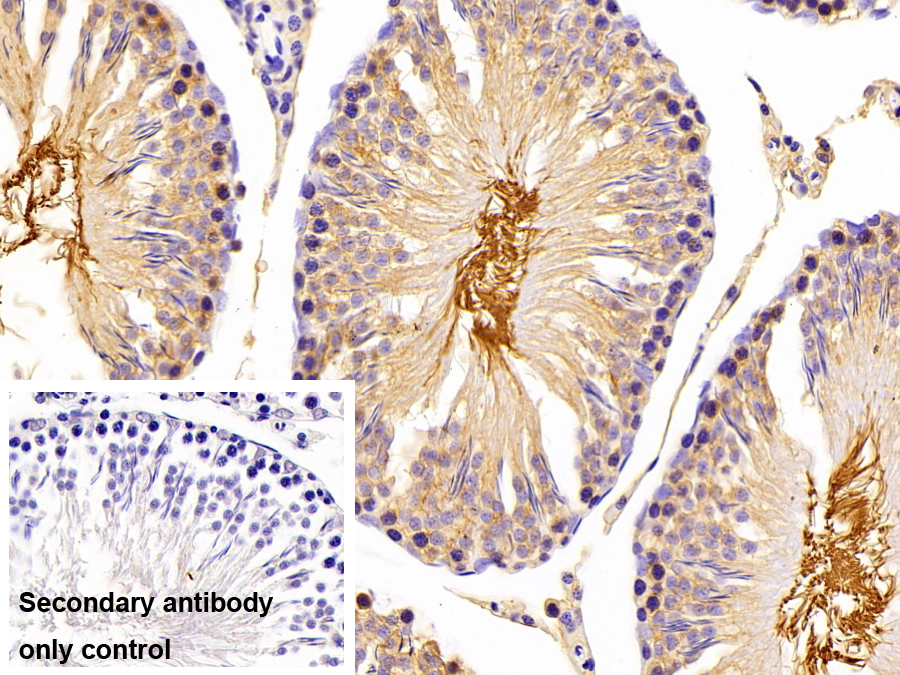 細(xì)胞外基質(zhì)金屬蛋白酶誘導(dǎo)因子(CD147)多克隆抗體