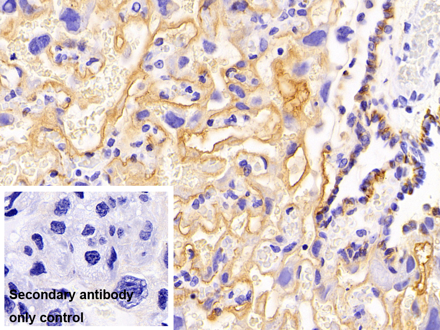 細(xì)胞外基質(zhì)金屬蛋白酶誘導(dǎo)因子(CD147)多克隆抗體