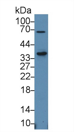 信号淋巴细胞激活分子家族成员1(SLAMF1)多克隆抗体
