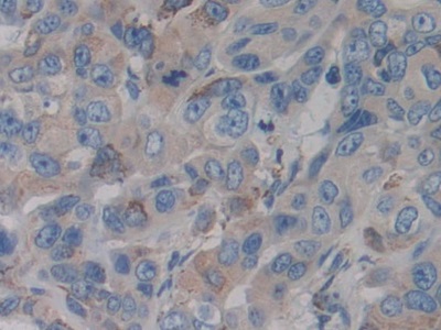 細(xì)胞色素P450家族成員21B(CYP21A2)多克隆抗體