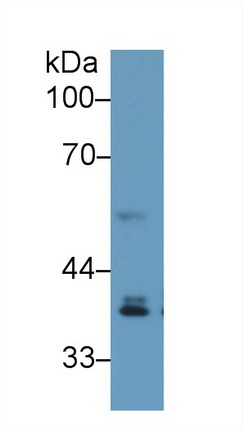 干擾素調(diào)節(jié)因子1(IRF1)多克隆抗體