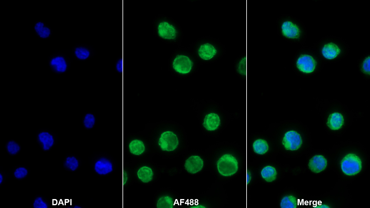 淋巴细胞功能关联抗原1α(CD11a)多克隆抗体