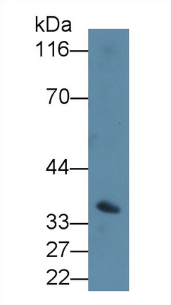 CD64分子(CD64)多克隆抗體