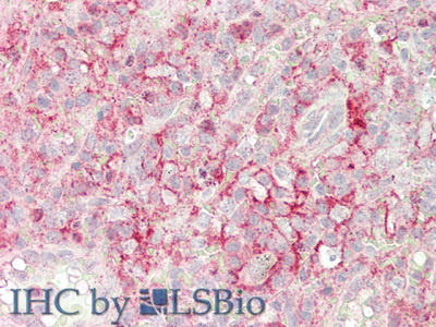 CD32分子(CD32)多克隆抗體