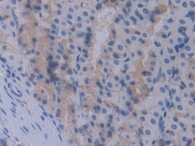 信号转导衔接分子1(STAM1)多克隆抗体