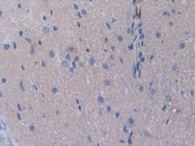 信号转导衔接分子1(STAM1)多克隆抗体