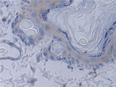 信号转导衔接分子1(STAM1)多克隆抗体