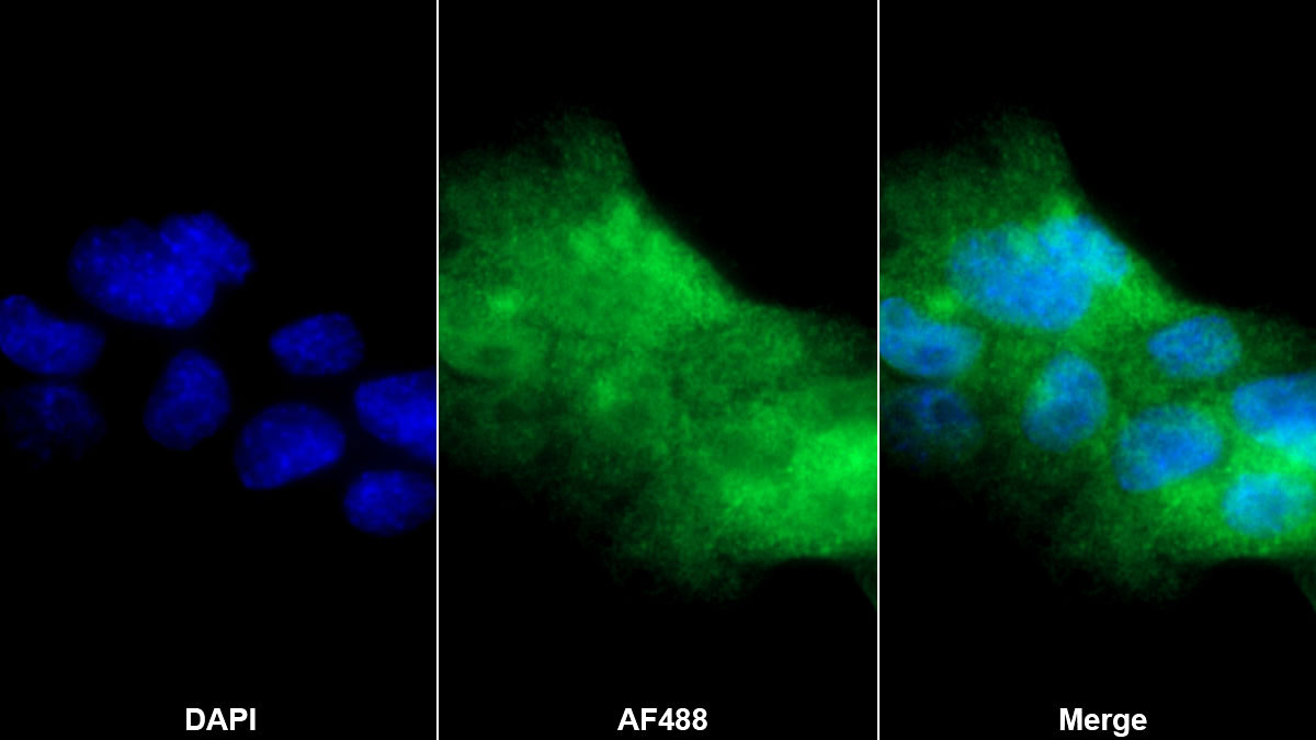 干擾素調節(jié)因子3(IRF3)多克隆抗體