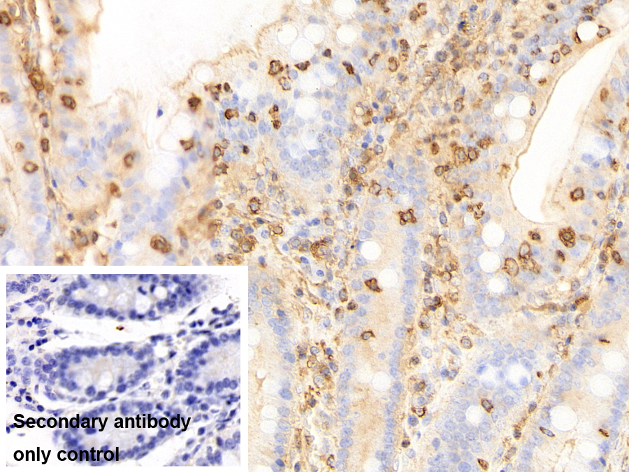 巨噬细胞清道夫受体1(MSR1)多克隆抗体