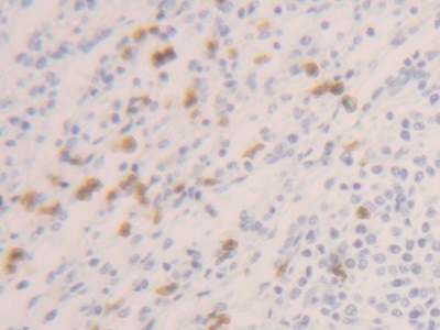 胱天蛋白酶1(CASP1)多克隆抗體