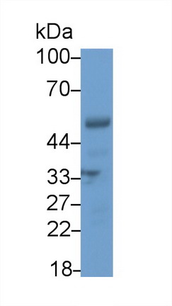 干扰素调节因子5(IRF5)多克隆抗体