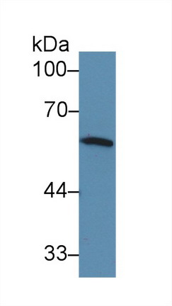 干扰素调节因子5(IRF5)多克隆抗体