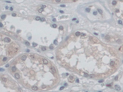 CD209分子(CD209)多克隆抗体