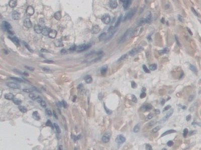 CD209分子(CD209)多克隆抗体
