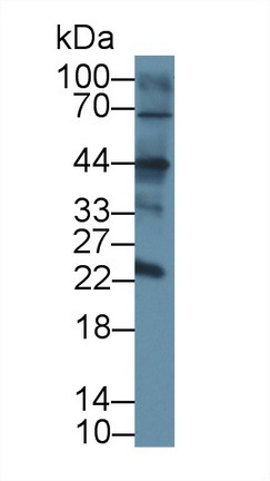 CD209分子(CD209)多克隆抗体