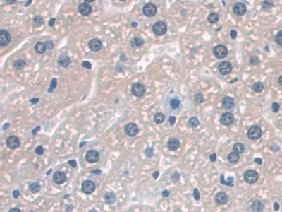 CD209分子(CD209)多克隆抗体