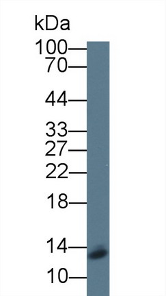9kDa信號識別顆粒(SRP9)多克隆抗體