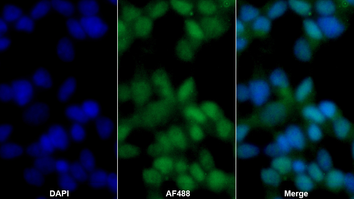 磷酸甘油酸变位酶2(PGAM2)多克隆抗体