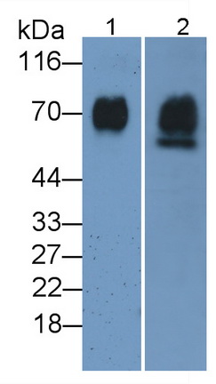 高尔基磷酸化蛋白2(GOLPH2)多克隆抗体