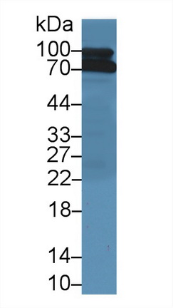 补体成分1s(C1s)多克隆抗体
