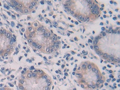 白介素28A(IL28A)多克隆抗體
