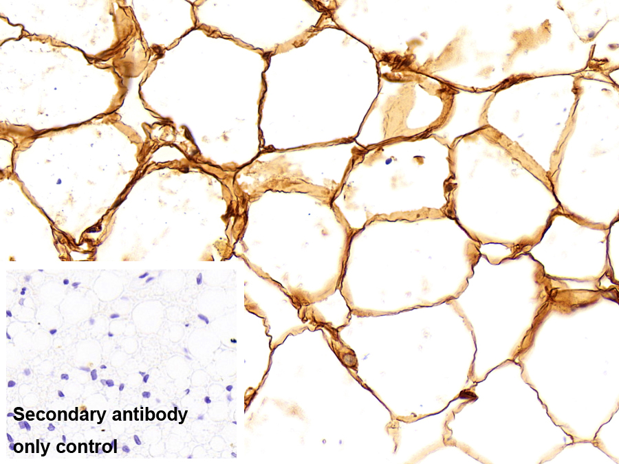 脂肪酸結(jié)合蛋白 4(FABP4)多克隆抗體