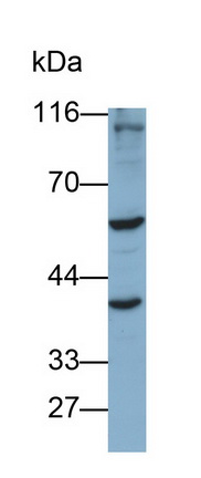 血管生成素样蛋白3(ANGPTL3)多克隆抗体
