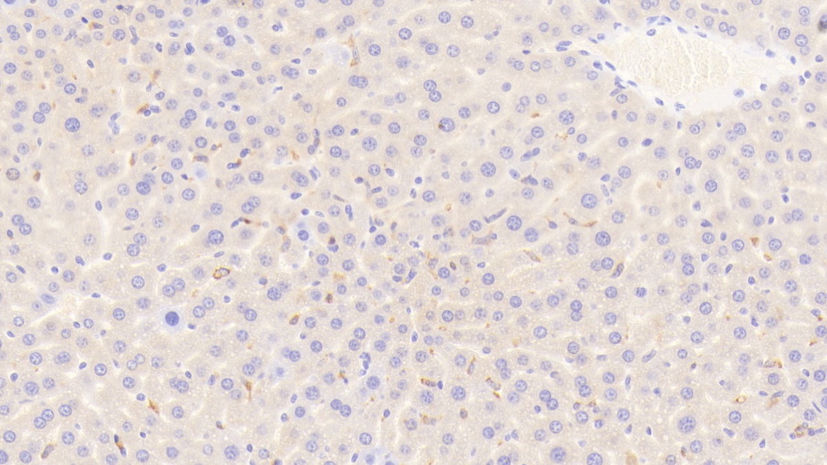 CD163分子(CD163)多克隆抗體