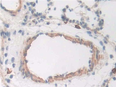 CD163分子(CD163)多克隆抗体