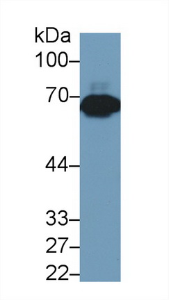 二氢嘧啶酶样蛋白3(DPYSL3)多克隆抗体