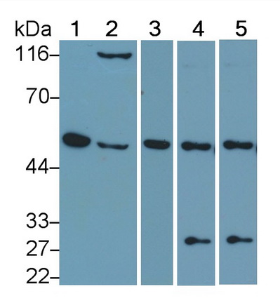 干扰素调节因子4(IRF4)多克隆抗体