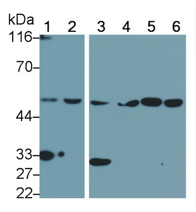 干扰素调节因子4(IRF4)多克隆抗体