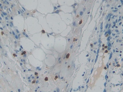 核糖核酸酶A3(RNASE3)多克隆抗體