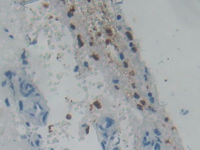 核糖核酸酶A3(RNASE3)多克隆抗體