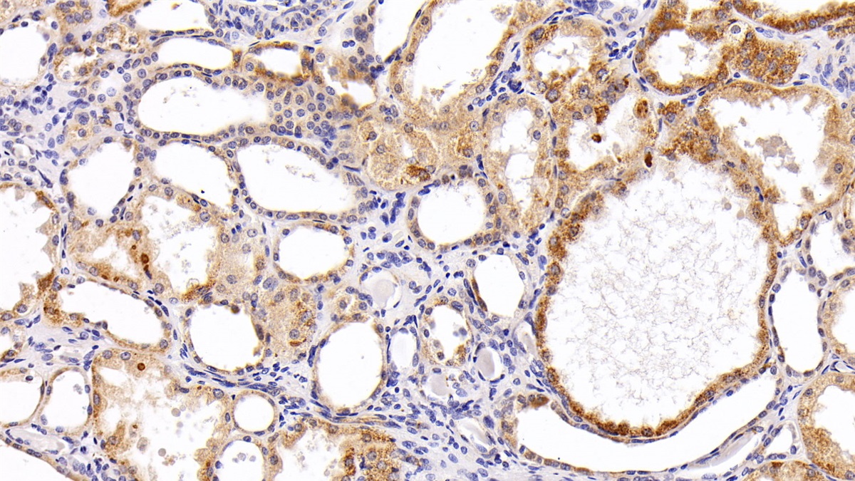 核糖核酸酶A3(RNASE3)多克隆抗體