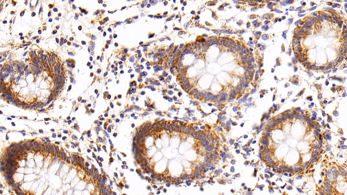 核糖核酸酶A3(RNASE3)多克隆抗體