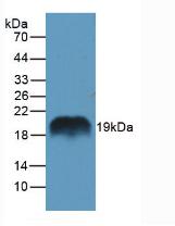 再生胰岛衍生蛋白1α(REG1a)多克隆抗体