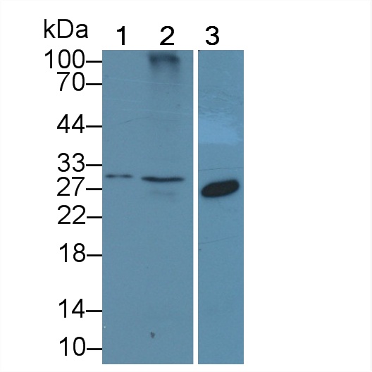 杀伤细胞凝集素样受体亚家族K成员1(KLRK1)多克隆抗体